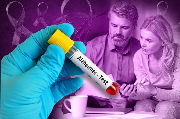 NIS says new blood test can spot Alzheimer risk 15 yrs prior to symptoms