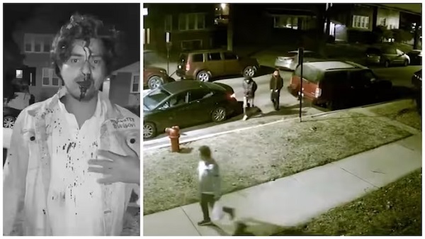 Indian student from Hyderabad attacked by robbers in Chicago