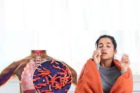 India’s Missing TB Cases Reduced from 1 Million in 2015 to 0.26 Million in 2023: Mandaviya