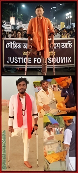 Soumik Mukherjee: Disability New Symbolism of Politics in WB